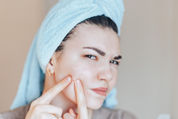 Acne And Pimple Treatment